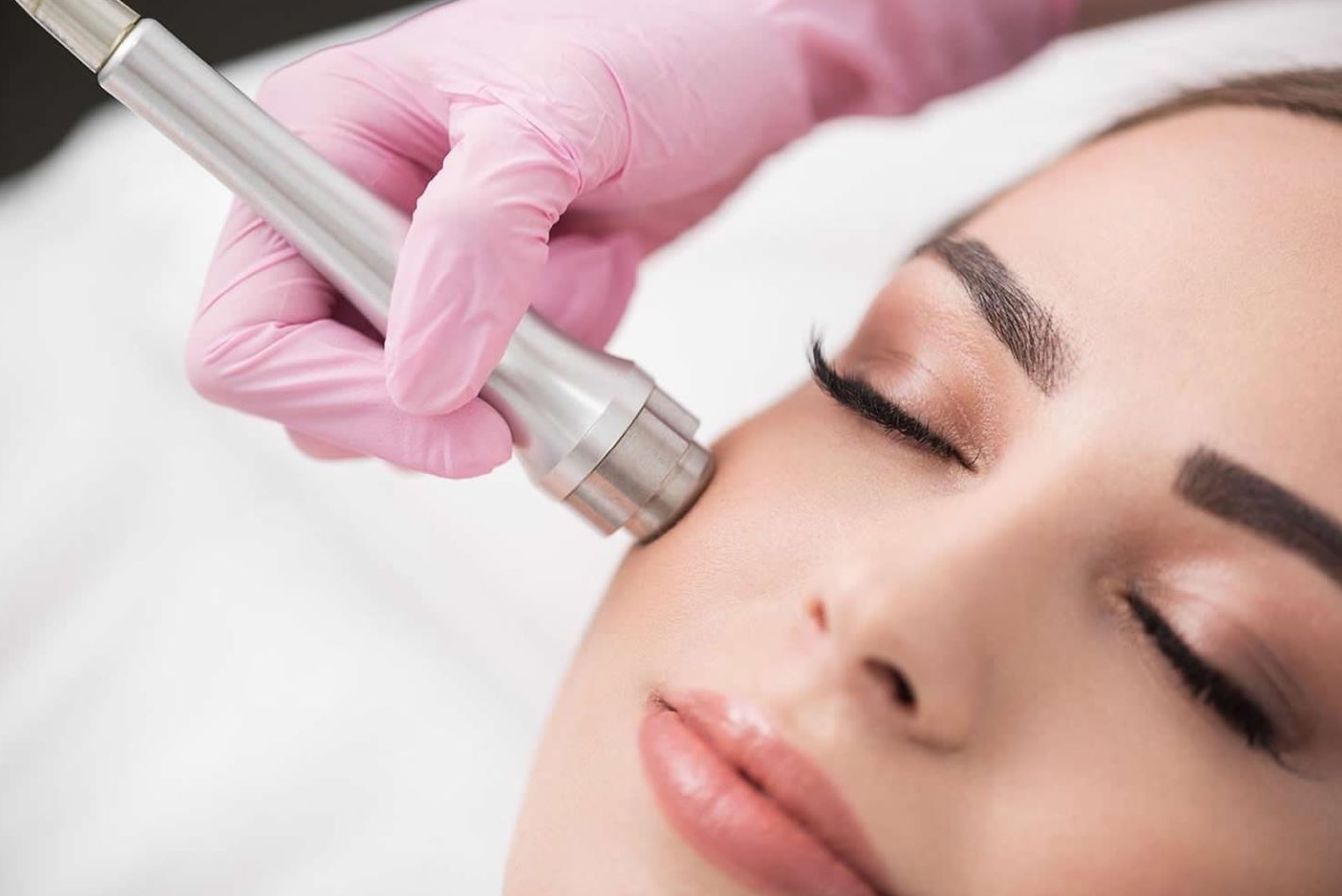 microdermabrasion los angeles